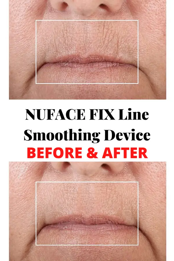 before-after-NuFACE-FIX-Line-Smoothing-Device