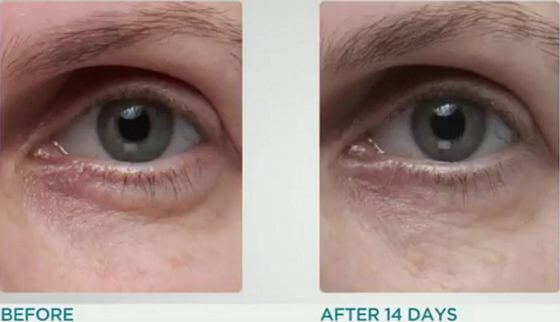 Dr-Dennis-Gross-Ferulic-Retinol-Triple-Correction-Eye-Serum-results