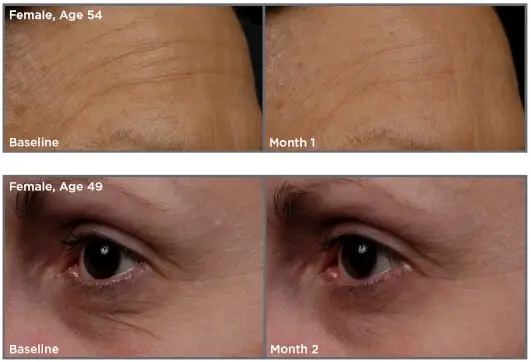 SkinMedica-TNS-Essential-Serum-results