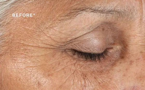 eye cream for wrinkles that works