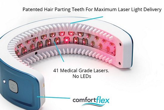 laser light therapy for hair loss