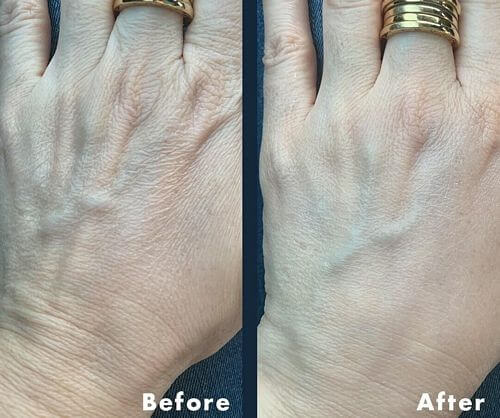 hand-cream-before-after