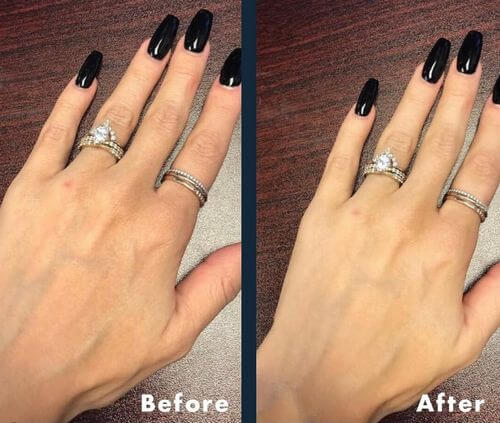 hands before after