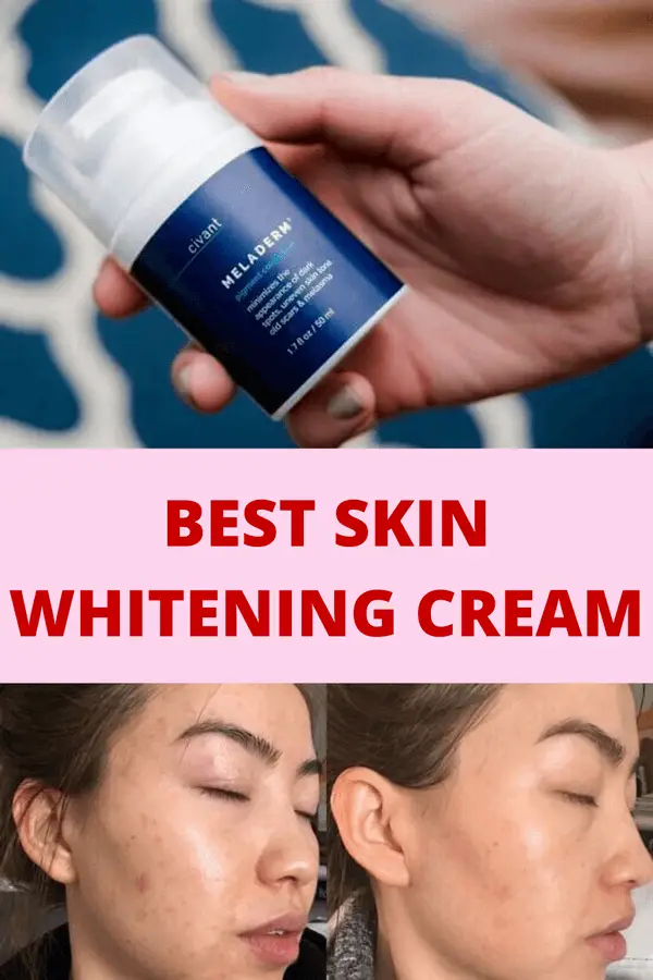 Best Skin Whitening Cream
