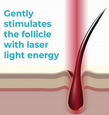 low level laser therapy for hair loss