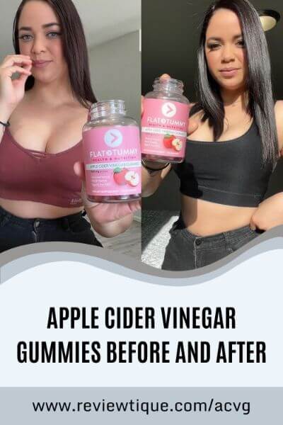 apple cider vinegar gummies before and after