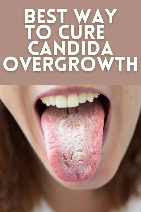candida-overgrowth-remedy