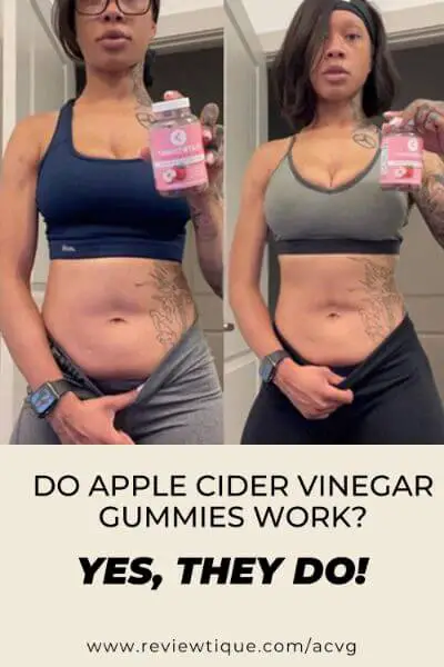 do apple cider vinegar gummies work? apple cider vinegar gummies benefits for wo