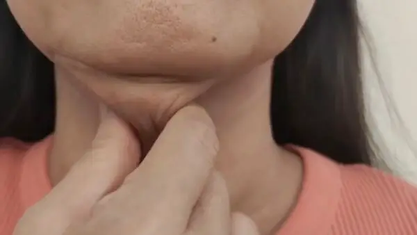 Double Chin Fat Removal