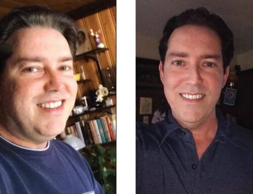 Perry lost 35 pounds in two months.