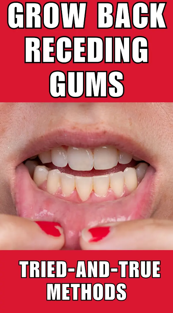 Grow Back Receding Gums