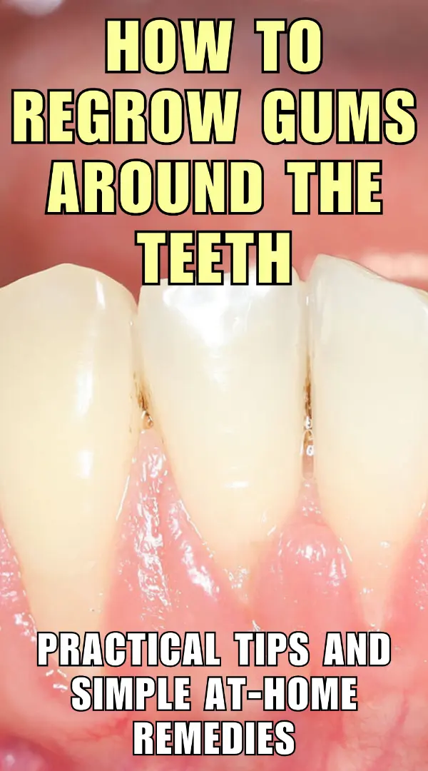 How to Regrow Gums Around The Teeth