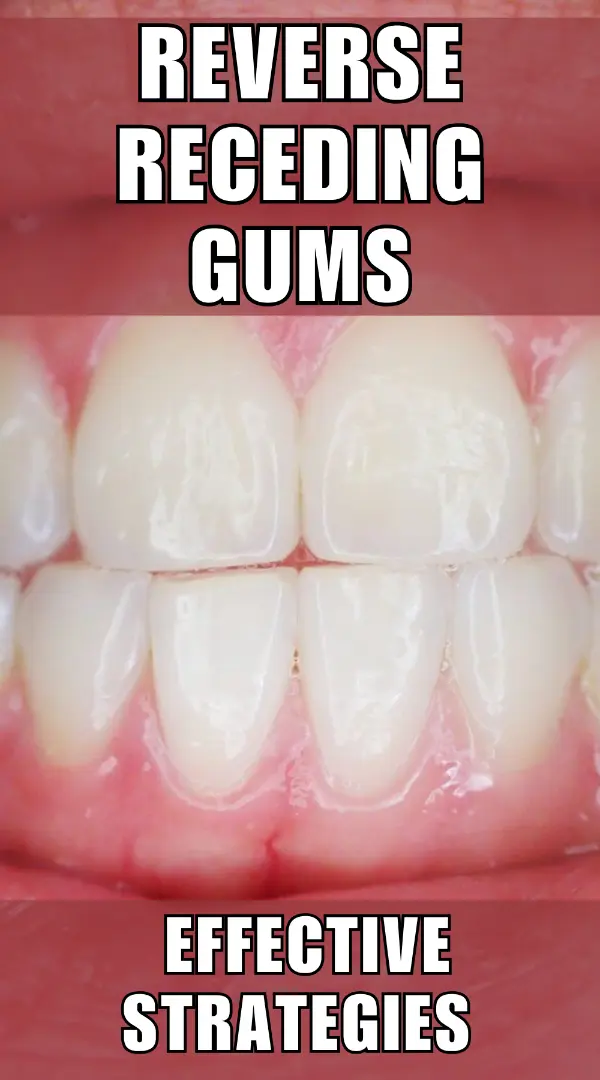 Reverse Receding Gums