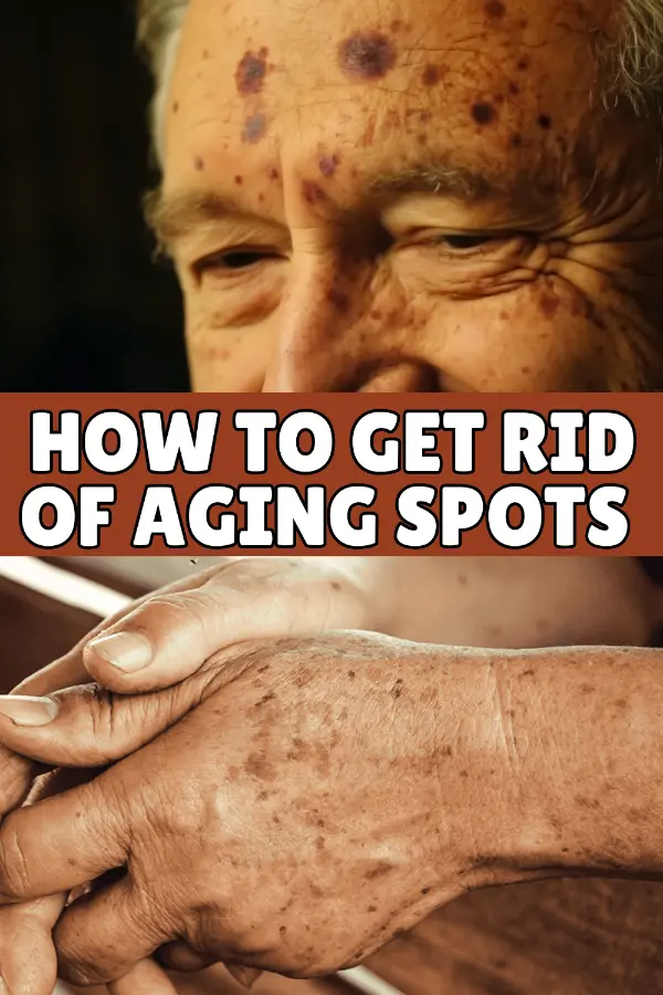 How to Get Rid of Aging Spots on Face & Hands