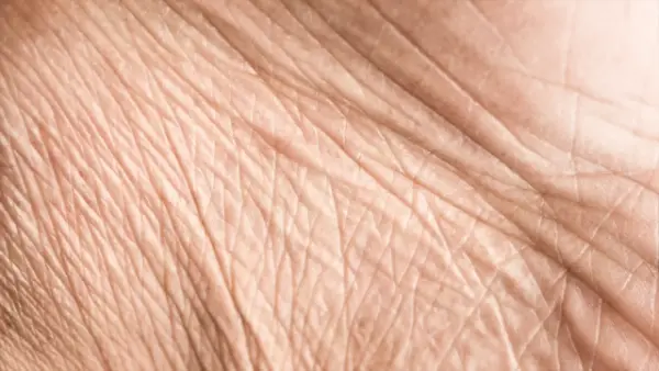 Crepey Skin