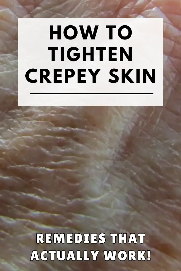 How to Tighten Crepey Skin